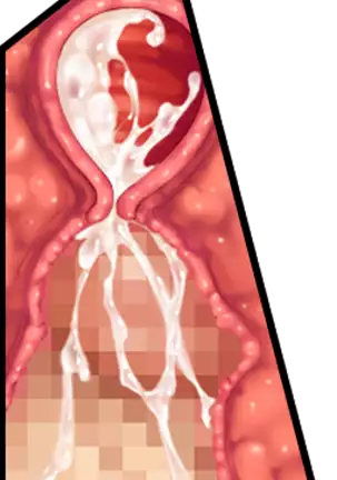 My Married Cousin's Need for Seed